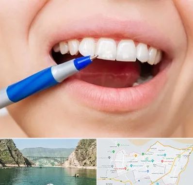 دندانسازی ارزان در ایلام