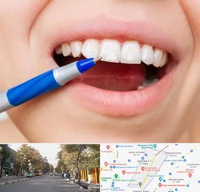 دندانسازی ارزان در شریعتی 