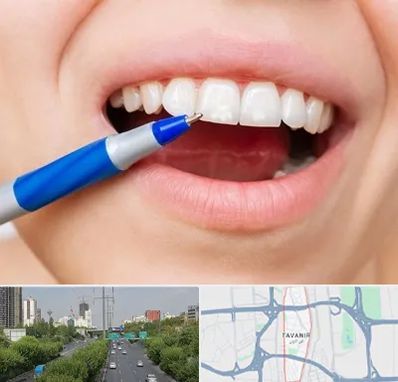 دندانسازی ارزان در توانیر