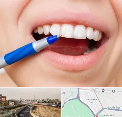 دندانسازی ارزان در جوادیه
