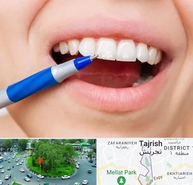 دندانسازی ارزان در تجریش 