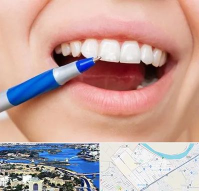 دندانسازی ارزان در کوروش اهواز 