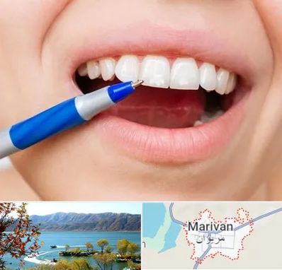 دندانسازی ارزان در مریوان