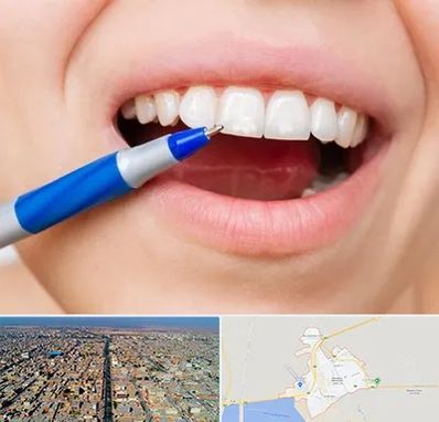 دندانسازی ارزان در بندر ماهشهر