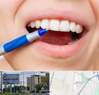 دندانسازی ارزان در فاز یک اندیشه