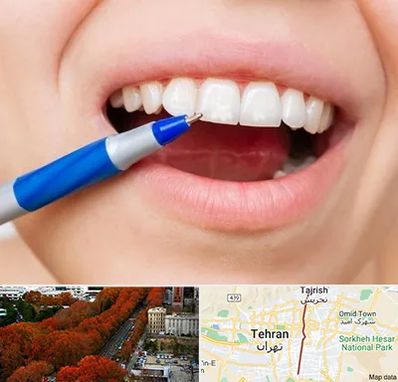 دندانسازی ارزان در ولیعصر 