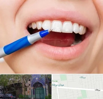 دندانسازی ارزان در بریانک