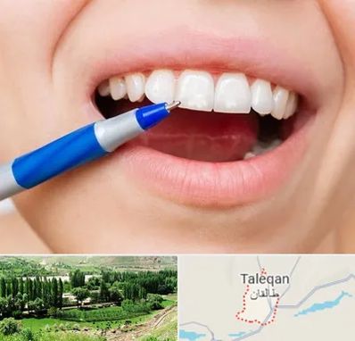 دندانسازی ارزان در طالقان
