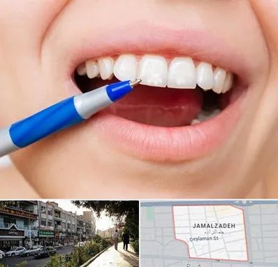 دندانسازی ارزان در خیابان جمالزاده