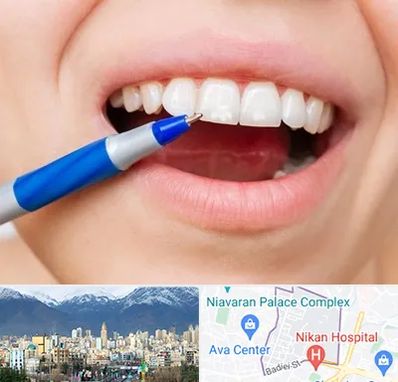 دندانسازی ارزان در آجودانیه 