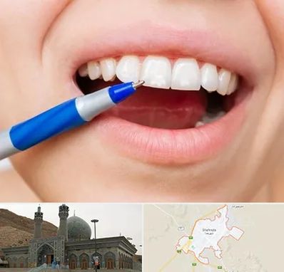 دندانسازی ارزان در شهرضا