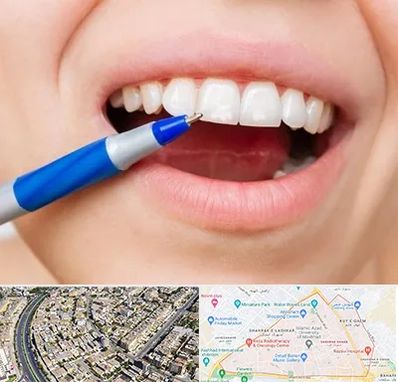 دندانسازی ارزان در شهرک غرب مشهد 