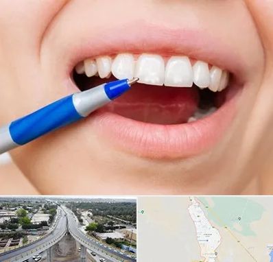 دندانسازی ارزان در اندیمشک