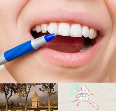 دندانسازی ارزان در تویسرکان