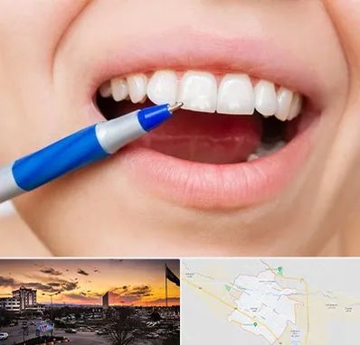 دندانسازی ارزان در قوچان