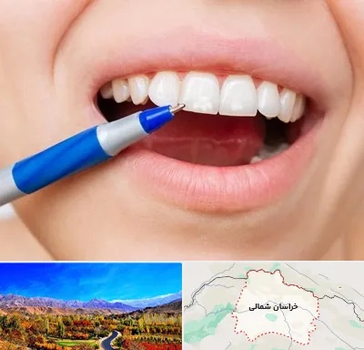 دندانسازی ارزان در خراسان شمالی