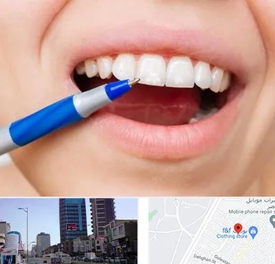 دندانسازی ارزان در چهارراه طالقانی کرج 