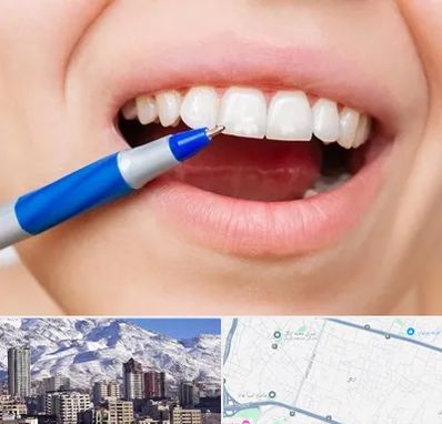 دندانسازی ارزان در ازگل