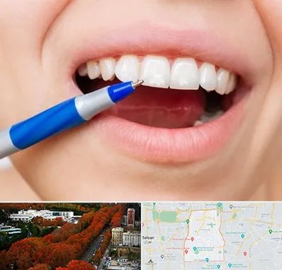 دندانسازی ارزان در منطقه 6 تهران 