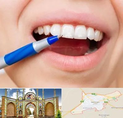 دندانسازی ارزان در سمنان