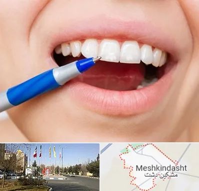 دندانسازی ارزان در مشکین دشت