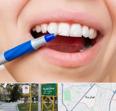 دندانسازی ارزان در تهران ویلا