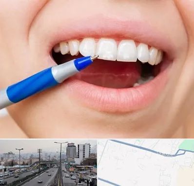 دندانسازی ارزان در بلوار ارتش