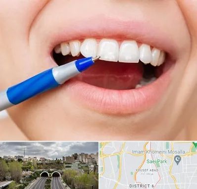 دندانسازی ارزان در یوسف آباد 