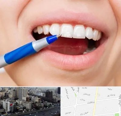 دندانسازی ارزان در زرتشت
