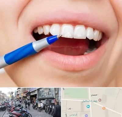 دندانسازی ارزان در چهارراه استانبول