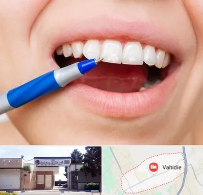 دندانسازی ارزان در وحیدیه شهریار
