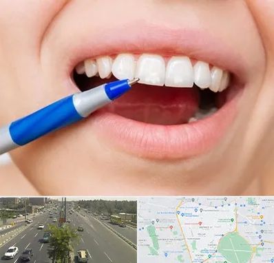 دندانسازی ارزان در منطقه 17 تهران 