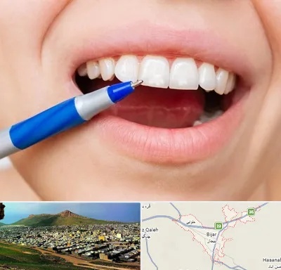 دندانسازی ارزان در بیجار