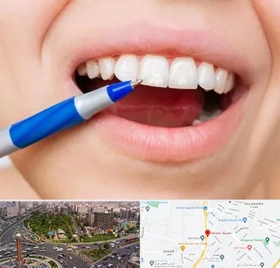 دندانسازی ارزان در سبلان 