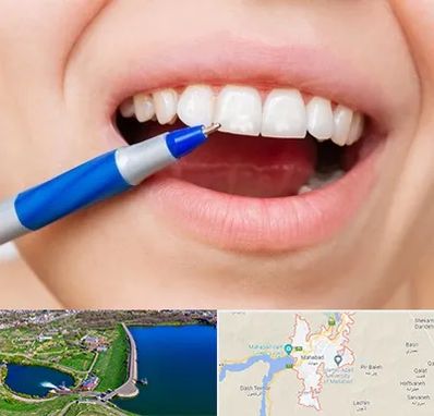 دندانسازی ارزان در مهاباد
