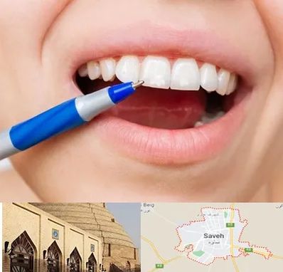 دندانسازی ارزان در ساوه