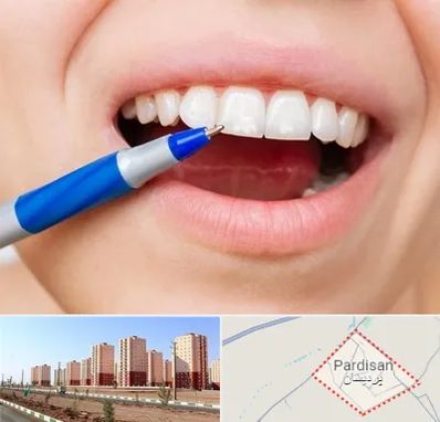 دندانسازی ارزان در پردیسان قم