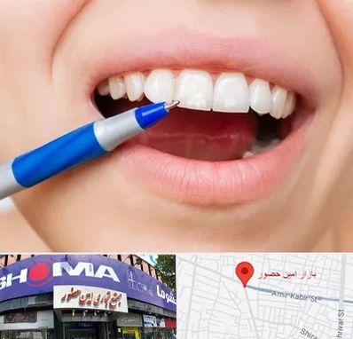 دندانسازی ارزان در امین حضور