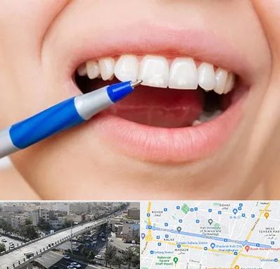 دندانسازی ارزان در فرجام 