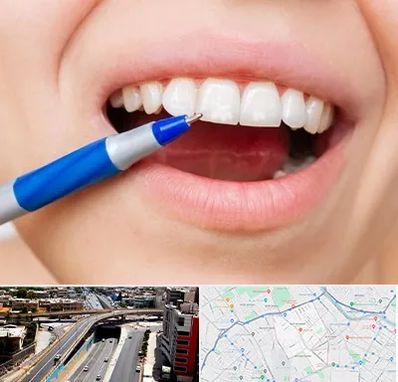 دندانسازی ارزان در ستارخان شیراز 