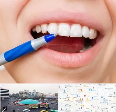 دندانسازی ارزان در میدان انقلاب 