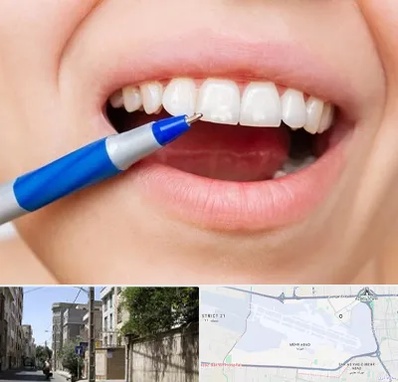 دندانسازی ارزان در مهرآباد