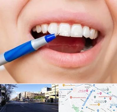 دندانسازی ارزان در خیابان ملاصدرا شیراز 