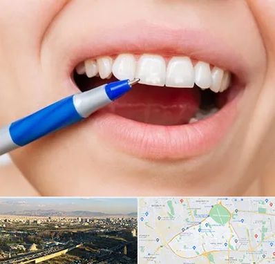 دندانسازی ارزان در منطقه 19 تهران 