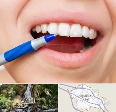 دندانسازی ارزان در الیگودرز