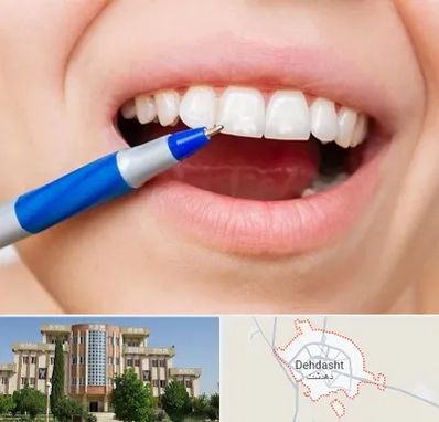 دندانسازی ارزان در دهدشت