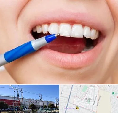 دندانسازی ارزان در فاز دو اندیشه