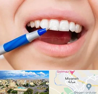 دندانسازی ارزان در میانه