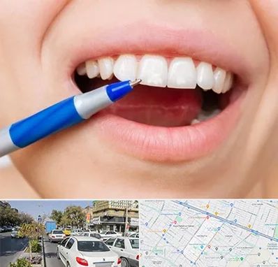 دندانسازی ارزان در مفتح مشهد 