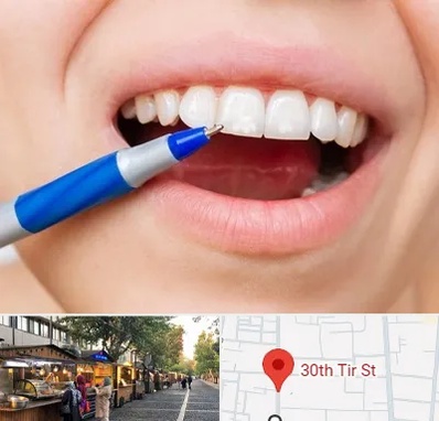 دندانسازی ارزان در سی تیر